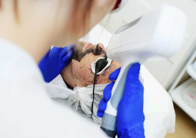 Результативность удаления бородавки азотом и особенности послепроцедурного ухода