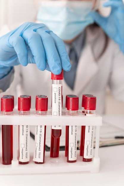 Профилактика заболеваний: какие анализы нужно сдать при густой крови?
