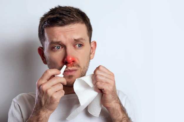 Причины кровотечения из носа у взрослого мужчины
