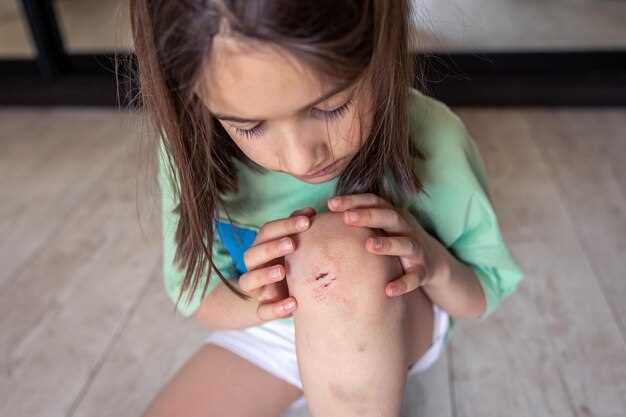 Когда следует обратиться к врачу при выявлении лишая у ребенка на руке