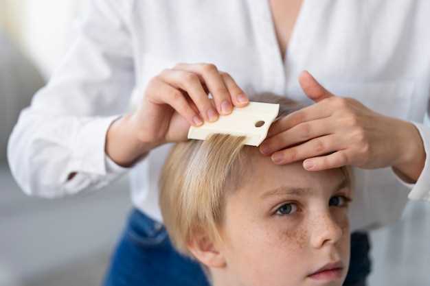 Эффективные методы лечения стригущего лишая у детей