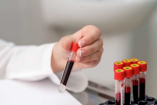 Исследование крови на онкологию: важность и правила подготовки