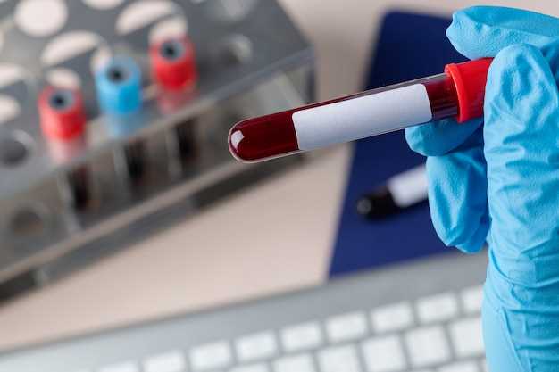 Биохимические анализы крови при подозрении на лейкоз