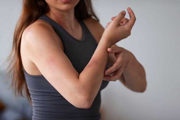 Как предотвратить появление аллергии на спине