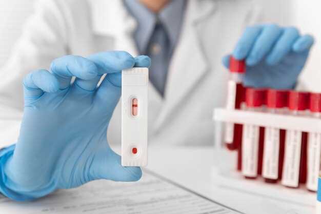 Изменения в общем анализе крови при ВИЧ