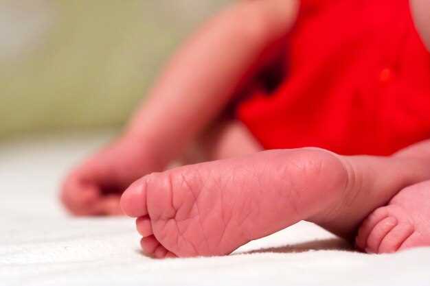 Красная попа у новорожденных: причины возникновения