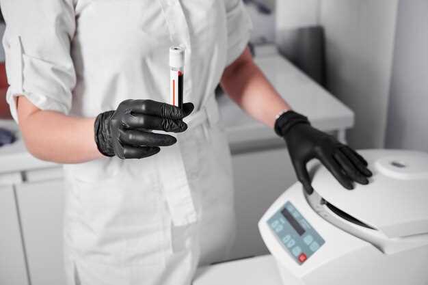 Как правильно сдавать анализ крови на группу и резус-фактор?