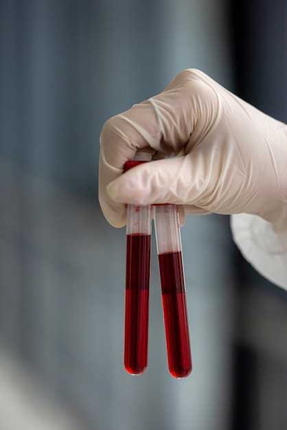 Общий клинический анализ крови: основные показатели