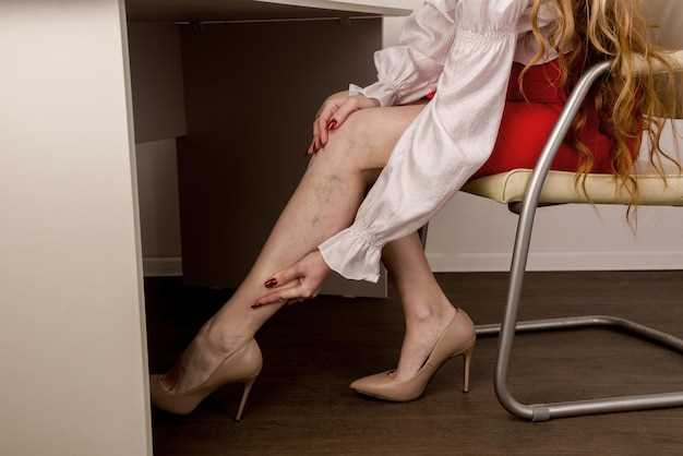 Причины отечности ног у женщин и способы ее устранения