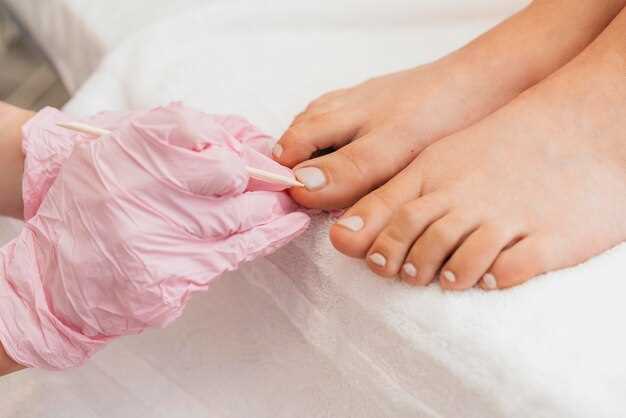 Болезни и состояния, которые могут влиять на запах ногтей