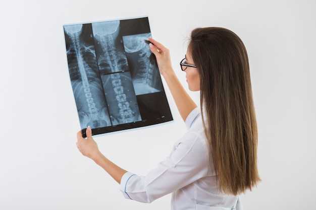 Что показывает рак кости на рентгеновском снимке?