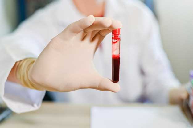 Ревмофактор анализ крови: как правильно интерпретировать результаты