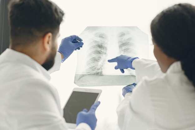 Признаки курильщика на рентгеновском снимке легких